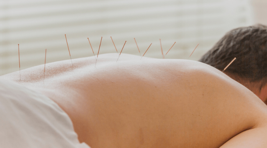 acupuntura dolor de cuello y espalda