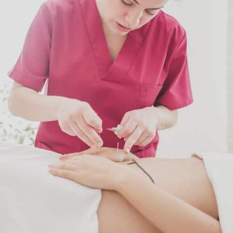 acupuntura-cerca (1) acupuntura-cerca (1)