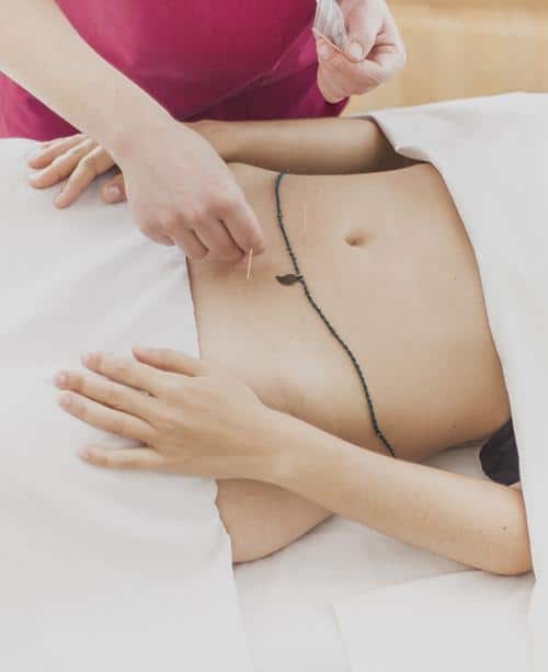 acupuntura ginecologia