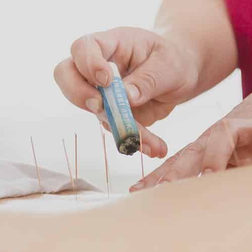 dolor-lumbar-acupuntura-meridians dolor-lumbar-acupuntura-meridians