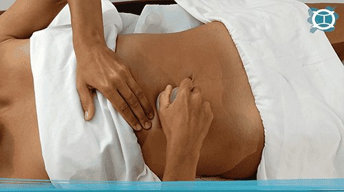 masaje con ventosa en abdomen